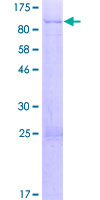 SYTL3 Protein - 12.5% SDS-PAGE of human SYTL3 stained with Coomassie Blue