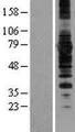 SYVN1 / HRD1 Protein - Western validation with an anti-DDK antibody * L: Control HEK293 lysate R: Over-expression lysate