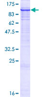 SYVN1 / HRD1 Protein - 12.5% SDS-PAGE of human SYVN1 stained with Coomassie Blue