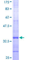 SYVN1 / HRD1 Protein - 12.5% SDS-PAGE Stained with Coomassie Blue.