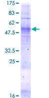 TAAR5 Protein - 12.5% SDS-PAGE of human TAAR5 stained with Coomassie Blue