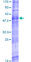 TAAR8 Protein - 12.5% SDS-PAGE of human TAAR8 stained with Coomassie Blue