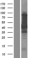 TAB1 Protein - Western validation with an anti-DDK antibody * L: Control HEK293 lysate R: Over-expression lysate