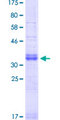 TAB1 Protein - 12.5% SDS-PAGE Stained with Coomassie Blue.