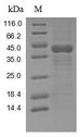 TAB2 Protein - (Tris-Glycine gel) Discontinuous SDS-PAGE (reduced) with 5% enrichment gel and 15% separation gel.
