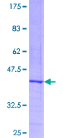 TAC1  Protein - 12.5% SDS-PAGE of human TAC1 stained with Coomassie Blue