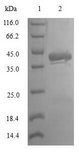 TAC1  Protein - (Tris-Glycine gel) Discontinuous SDS-PAGE (reduced) with 5% enrichment gel and 15% separation gel.