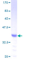TAC3 / Tachykinin Protein - 12.5% SDS-PAGE of human TAC3 stained with Coomassie Blue