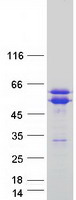 TACC1 Protein - Purified recombinant protein TACC1 was analyzed by SDS-PAGE gel and Coomassie Blue Staining