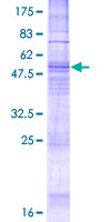 TACR1 / NK1R Protein - 12.5% SDS-PAGE of human TACR1 stained with Coomassie Blue