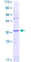 TACR1 / NK1R Protein - 12.5% SDS-PAGE Stained with Coomassie Blue.