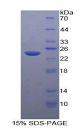 TACR2 / NK2R Protein - Recombinant Tachykinin Receptor 2 By SDS-PAGE