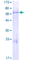 TADA1 / ADA1 Protein - 12.5% SDS-PAGE of human TADA1L stained with Coomassie Blue