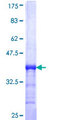 TADA2B Protein - 12.5% SDS-PAGE Stained with Coomassie Blue.