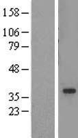 TADA2L / ADA2A Protein - Western validation with an anti-DDK antibody * L: Control HEK293 lysate R: Over-expression lysate
