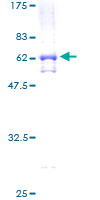 TADA2L / ADA2A Protein - 12.5% SDS-PAGE of human TADA2L stained with Coomassie Blue