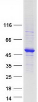 TADA3 / ADA3 Protein - Purified recombinant protein TADA3 was analyzed by SDS-PAGE gel and Coomassie Blue Staining