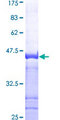 TAF1 Protein - 12.5% SDS-PAGE Stained with Coomassie Blue