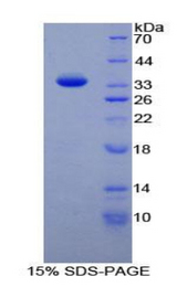 TAF1 Protein - Recombinant TATA Box Binding Protein Associated Factor 1 By SDS-PAGE