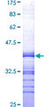 TAF10 Protein - 12.5% SDS-PAGE Stained with Coomassie Blue.
