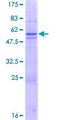 TAF11 Protein - 12.5% SDS-PAGE of human TAF11 stained with Coomassie Blue
