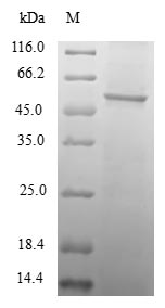 TAF11 Protein - (Tris-Glycine gel) Discontinuous SDS-PAGE (reduced) with 5% enrichment gel and 15% separation gel.