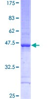 TAF12 Protein - 12.5% SDS-PAGE of human TAF12 stained with Coomassie Blue