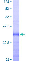 TAF12 Protein - 12.5% SDS-PAGE Stained with Coomassie Blue.
