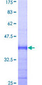 TAF12 Protein - 12.5% SDS-PAGE Stained with Coomassie Blue.