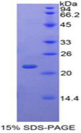 TAF12 Protein - Recombinant TATA Box Binding Protein Associated Factor 12 By SDS-PAGE