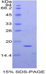 TAF13 Protein - Recombinant TATA Box Binding Protein Associated Factor 13 By SDS-PAGE