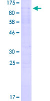 TAF15 Protein - 12.5% SDS-PAGE of human TAF15 stained with Coomassie Blue