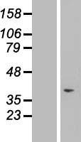TAF1D Protein - Western validation with an anti-DDK antibody * L: Control HEK293 lysate R: Over-expression lysate