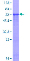 TAF5L Protein - 12.5% SDS-PAGE of human TAF5L stained with Coomassie Blue