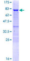 TAF7 Protein - 12.5% SDS-PAGE of human TAF7 stained with Coomassie Blue