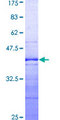 TAF7 Protein - 12.5% SDS-PAGE Stained with Coomassie Blue.