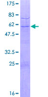 TAF9 Protein - 12.5% SDS-PAGE of human TAF9 stained with Coomassie Blue