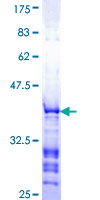 TAF9 Protein - 12.5% SDS-PAGE Stained with Coomassie Blue.