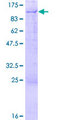 TAFII70 / TAF6 Protein - 12.5% SDS-PAGE of human TAF6 stained with Coomassie Blue