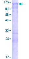 TAGAP Protein - 12.5% SDS-PAGE of human TAGAP stained with Coomassie Blue
