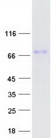 TAGAP Protein - Purified recombinant protein TAGAP was analyzed by SDS-PAGE gel and Coomassie Blue Staining