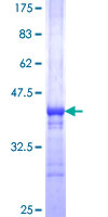 TAGLN / Transgelin / SM22 Protein - 12.5% SDS-PAGE Stained with Coomassie Blue.