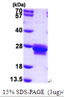 TAGLN / Transgelin / SM22 Protein