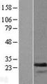 TAGLN2 / Transgelin 2 Protein - Western validation with an anti-DDK antibody * L: Control HEK293 lysate R: Over-expression lysate