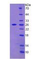 TAGLN2 / Transgelin 2 Protein - Recombinant Transgelin 2 By SDS-PAGE