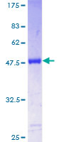 TAGLN3 / Neuronal Protein 22 Protein - 12.5% SDS-PAGE of human TAGLN3 stained with Coomassie Blue