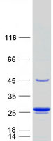 TAGLN3 / Neuronal Protein 22 Protein - Purified recombinant protein TAGLN3 was analyzed by SDS-PAGE gel and Coomassie Blue Staining