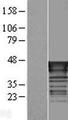 TAL1 Protein - Western validation with an anti-DDK antibody * L: Control HEK293 lysate R: Over-expression lysate