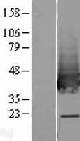 TALDO1 / Transaldolase 1 Protein - Western validation with an anti-DDK antibody * L: Control HEK293 lysate R: Over-expression lysate