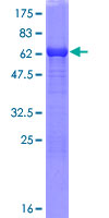 TALDO1 / Transaldolase 1 Protein - 12.5% SDS-PAGE of human TALDO1 stained with Coomassie Blue
